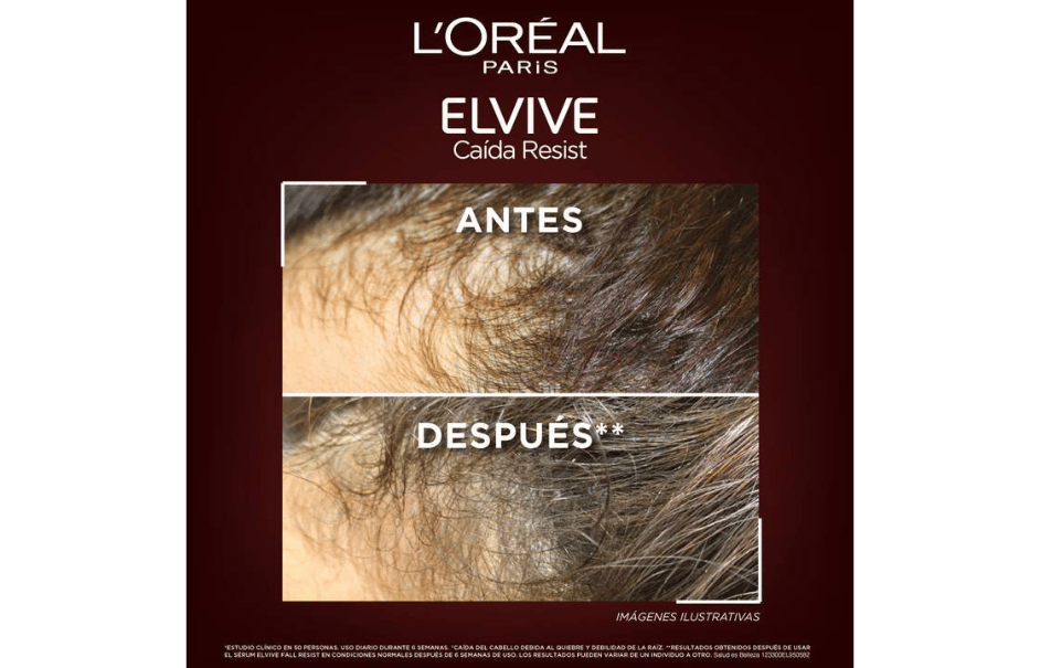 Productos para la caída del cabello